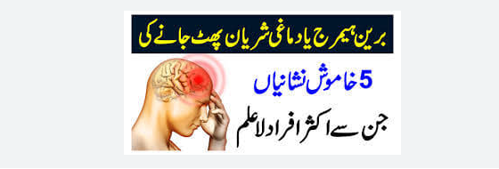 دماغ کی شریان پھٹنا ۔۔۔💯🌹 ٹینشن پیدا کرنے والے کام نہ کریں ز… See more